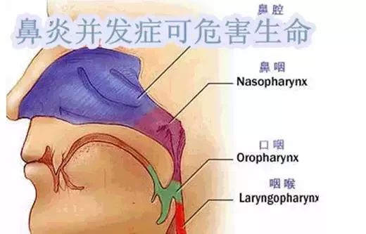 鼻子痰常年不断，鼻子经常有痰经常要吐 